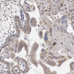 Invitrogen MGAT1 Polyclonal Antibody 100 &mu;L; Unconjugated:Antibodies,