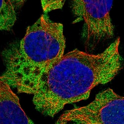 Invitrogen ABCF1 Polyclonal Antibody 100 &mu;L; Unconjugated:Antibodies,