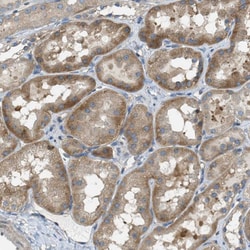 Invitrogen ABCF1 Polyclonal Antibody 100 &mu;L; Unconjugated:Antibodies,