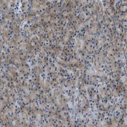 Invitrogen ABCF1 Polyclonal Antibody 100 &mu;L; Unconjugated:Antibodies,