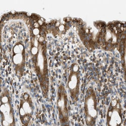 Invitrogen ABCF1 Polyclonal Antibody 100 &mu;L; Unconjugated:Antibodies,