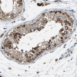 Invitrogen ABCF1 Polyclonal Antibody 100 &mu;L; Unconjugated:Antibodies,