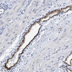 Invitrogen DARC Polyclonal Antibody 100 &mu;L; Unconjugated:Antibodies,