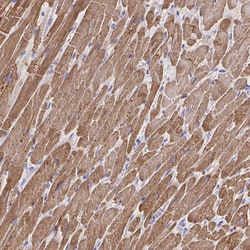 Invitrogen Cardiac Troponin T Polyclonal Antibody 100 &mu;L; Unconjugated:Antibodies,