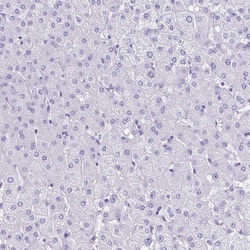 Invitrogen Cardiac Troponin T Polyclonal Antibody 100 &mu;L; Unconjugated:Antibodies,