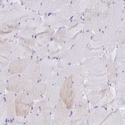 Invitrogen Cardiac Troponin T Polyclonal Antibody 100 &mu;L; Unconjugated:Antibodies,