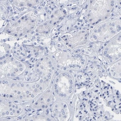 Invitrogen Cytokeratin 1 Polyclonal Antibody 100 &mu;L; Unconjugated:Antibodies,
