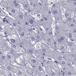Invitrogen AAK1 Polyclonal Antibody 100 &mu;L; Unconjugated:Antibodies,