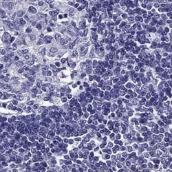 Invitrogen AAK1 Polyclonal Antibody 100 &mu;L; Unconjugated:Antibodies,