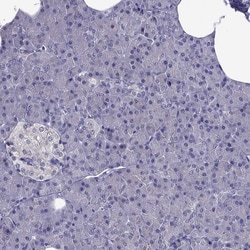 Invitrogen AAK1 Polyclonal Antibody 100 &mu;L; Unconjugated:Antibodies,