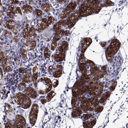 Invitrogen AAK1 Polyclonal Antibody 100 &mu;L; Unconjugated:Antibodies,