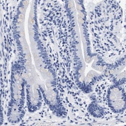 Invitrogen ATP6V0A4 Polyclonal Antibody 100 &mu;L; Unconjugated:Antibodies,