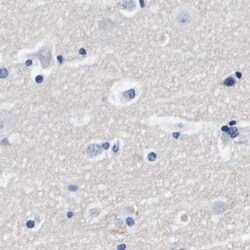 Invitrogen ATP6V0A4 Polyclonal Antibody 100 &mu;L; Unconjugated:Antibodies,