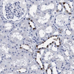 Invitrogen ATP6V0A4 Polyclonal Antibody 100 &mu;L; Unconjugated:Antibodies,