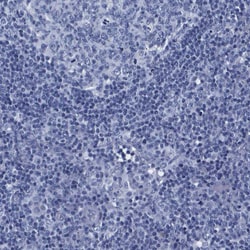 Invitrogen ATP6V0A4 Polyclonal Antibody 100 &mu;L; Unconjugated:Antibodies,