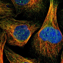 Invitrogen RNF141 Polyclonal Antibody 100 &mu;L; Unconjugated:Antibodies,