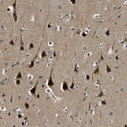 Invitrogen RNF141 Polyclonal Antibody 100 &mu;L; Unconjugated:Antibodies,