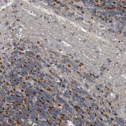 Invitrogen GOT2 Polyclonal Antibody 100 &mu;L; Unconjugated:Antibodies,