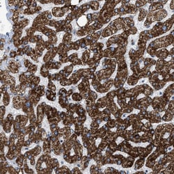 Invitrogen GOT2 Polyclonal Antibody 100 &mu;L; Unconjugated:Antibodies,