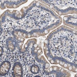 Invitrogen GOT2 Polyclonal Antibody 100 &mu;L; Unconjugated:Antibodies,