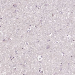 Invitrogen SIGLEC6 Polyclonal Antibody 100 &mu;L; Unconjugated:Antibodies,