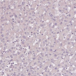 Invitrogen SIGLEC6 Polyclonal Antibody 100 &mu;L; Unconjugated:Antibodies,