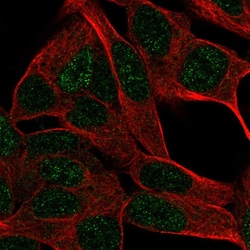 Invitrogen DUSP26 Polyclonal Antibody 100 &mu;L; Unconjugated:Antibodies,