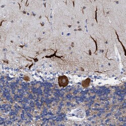 Invitrogen DUSP26 Polyclonal Antibody 100 &mu;L; Unconjugated:Antibodies,