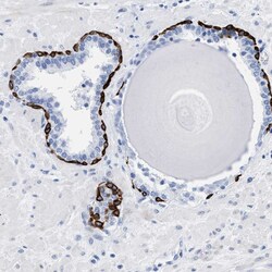 Invitrogen DUSP26 Polyclonal Antibody 100 &mu;L; Unconjugated:Antibodies,