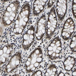 Invitrogen POLDIP3 Polyclonal Antibody 100 &mu;L; Unconjugated:Antibodies,