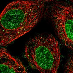Invitrogen NUP35 Polyclonal Antibody 100 &mu;L; Unconjugated:Antibodies,
