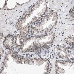Invitrogen NUP35 Polyclonal Antibody 100 &mu;L; Unconjugated:Antibodies,
