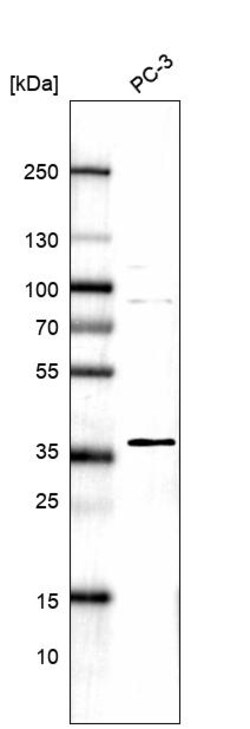 Invitrogen NUP35 Polyclonal Antibody 100 &mu;L | Buy Online | Invitrogen&trade; | Fisher Scientific
