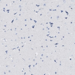 Invitrogen IL-16 Polyclonal Antibody 100 &mu;L | Buy Online | Invitrogen&trade; | Fisher Scientific