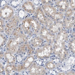 Invitrogen IL-16 Polyclonal Antibody 100 &mu;L | Buy Online | Invitrogen&trade; | Fisher Scientific