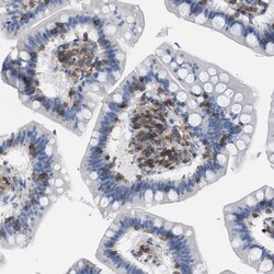 Invitrogen IL-16 Polyclonal Antibody 100 &mu;L | Buy Online | Invitrogen&trade; | Fisher Scientific