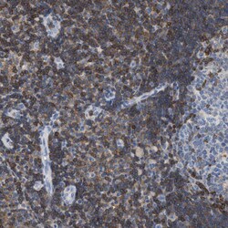 Invitrogen IL-16 Polyclonal Antibody 100 &mu;L | Buy Online | Invitrogen&trade; | Fisher Scientific