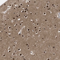 Invitrogen ZNF346 Polyclonal Antibody 100 &mu;L; Unconjugated:Antibodies,