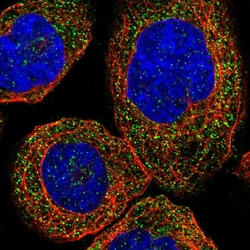 Invitrogen ZDHHC13 Polyclonal Antibody 100 &mu;L; Unconjugated:Antibodies,