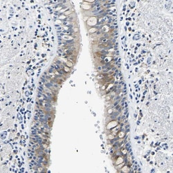 Invitrogen ZDHHC13 Polyclonal Antibody 100 &mu;L; Unconjugated:Antibodies,