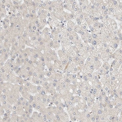 Invitrogen CAPG Polyclonal Antibody 100 &mu;L; Unconjugated:Antibodies,
