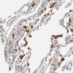 Invitrogen CAPG Polyclonal Antibody 100 &mu;L; Unconjugated:Antibodies,