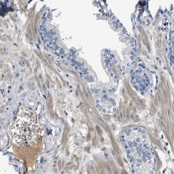 Invitrogen C1S Polyclonal Antibody 100 &mu;L; Unconjugated:Antibodies,