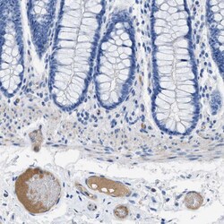 Invitrogen Apolipoprotein L1 Polyclonal Antibody 100 &mu;L; Unconjugated:Antibodies,