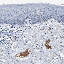 Invitrogen Apolipoprotein L1 Polyclonal Antibody 100 &mu;L; Unconjugated:Antibodies,