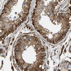 Invitrogen NADE Polyclonal Antibody 100 &mu;L; Unconjugated:Antibodies,