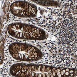 Invitrogen RNF12 Polyclonal Antibody 100 &mu;L; Unconjugated:Antibodies,