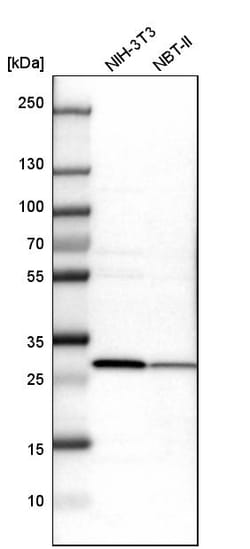 Invitrogen ETFB Polyclonal Antibody 100 &mu;L; Unconjugated:Antibodies,