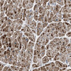 Invitrogen ETFB Polyclonal Antibody 100 &mu;L; Unconjugated:Antibodies,