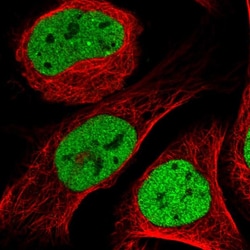 Invitrogen CtBP1 Polyclonal Antibody 100 &mu;L; Unconjugated:Antibodies,